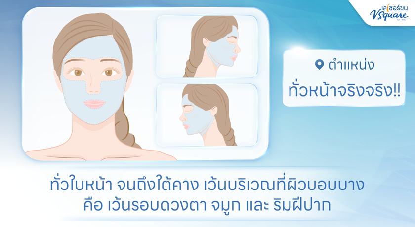 V Square Clinic (Paseo Kanchanaphisek)  %E0%B8%97%E0%B8%B1%E0%B9%88%E0%B8%A7%E0%B8%AB%E0%B8%99%E0%B9%89%E0%B8%B2