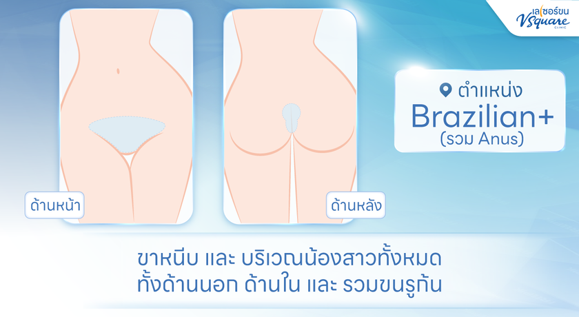 V Square Clinic (The Promenade) V Square Clinic (เดอะพรอมานาด) Brazilian