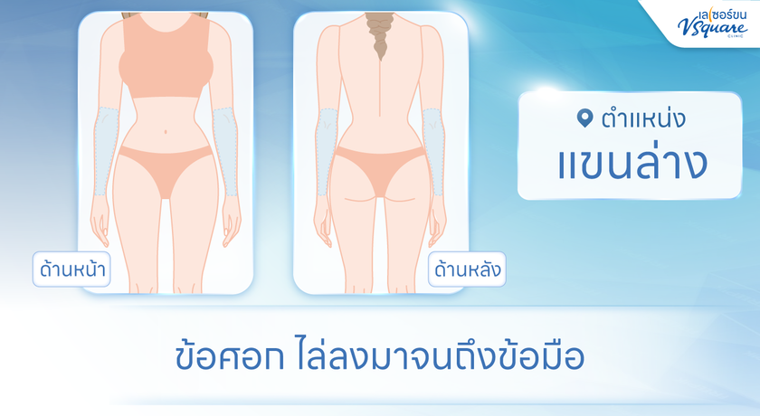 V Square Clinic (Major Ratchayothin) V Square Clinic (เมเจอร์รัชโยธิน) %E0%B9%81%E0%B8%82%E0%B8%99%E0%B8%A5%E0%B9%88%E0%B8%B2%E0%B8%87