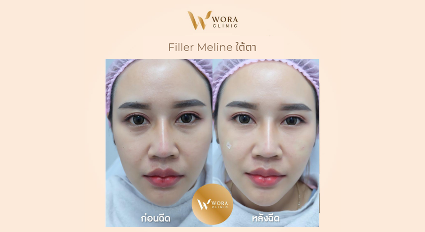 Wora Clinic  6