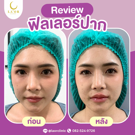 Laor Clinic Laor Clinic image_picker_35804997-0411-4FF9-87C2-11FF6113FC03-13883-00000484852ACEBB