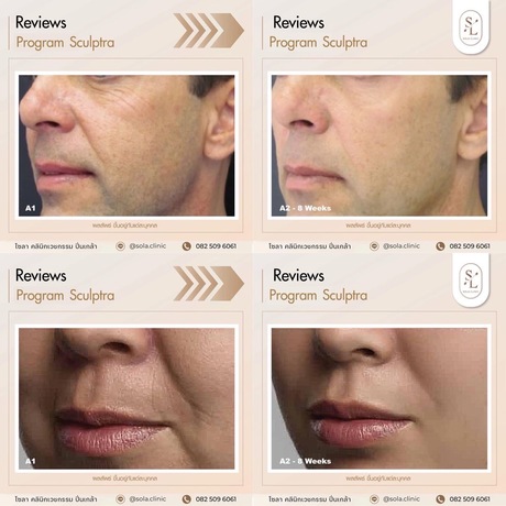 SOLA Clinic Pinklao SOLA Clinic Pinklao  image_picker_E1916B1C-F3A3-41AB-9BA7-DB27F6DFC849-407-0000004636EA6544