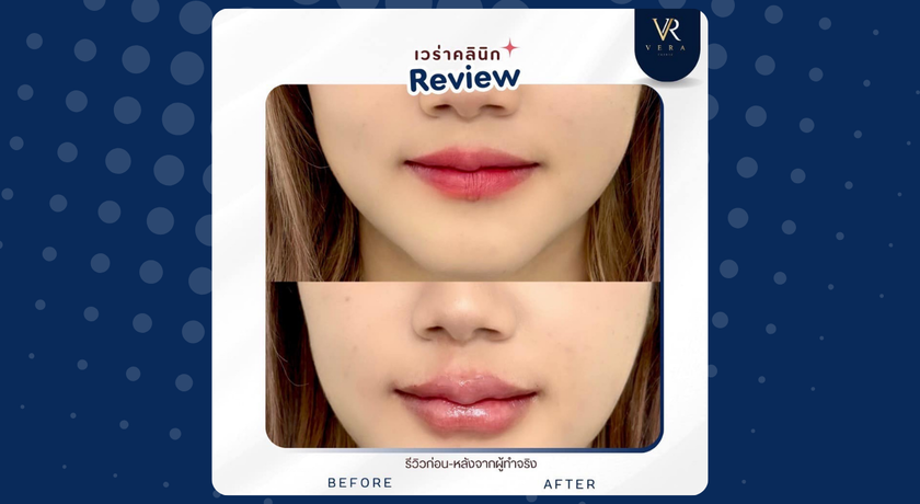 Vera Clinic (Chiang Mai)  4