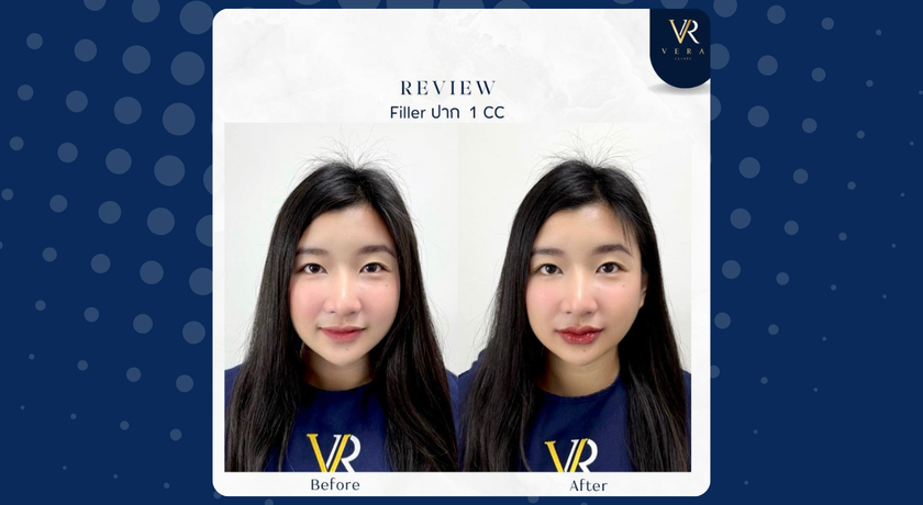 Vera Clinic (Chiang Mai)  5