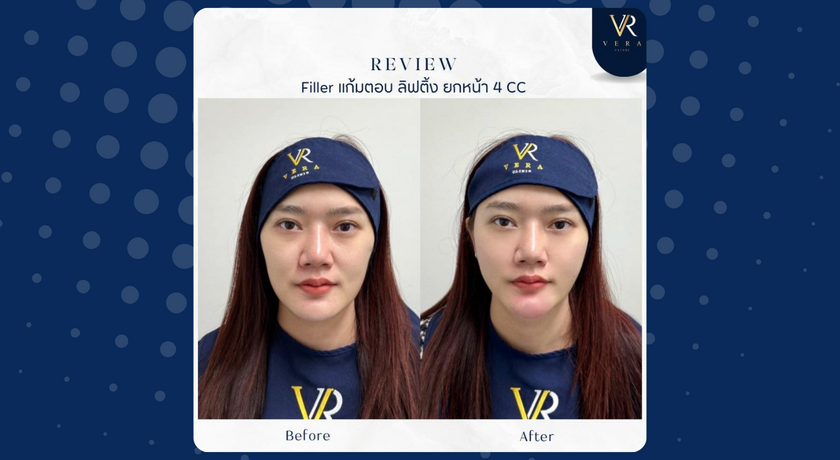 Vera Clinic (Chiang Mai)  6