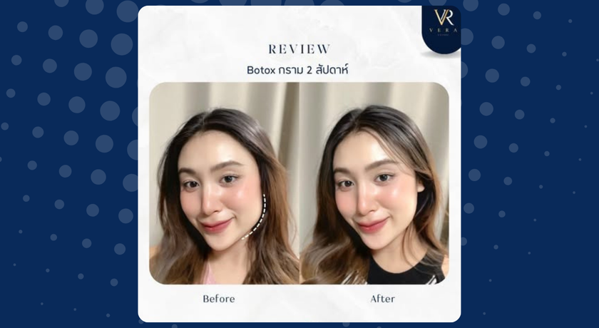 Vera Clinic (Chiang Mai)  7