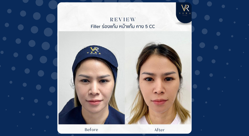 Vera Clinic (Chiang Mai)  8