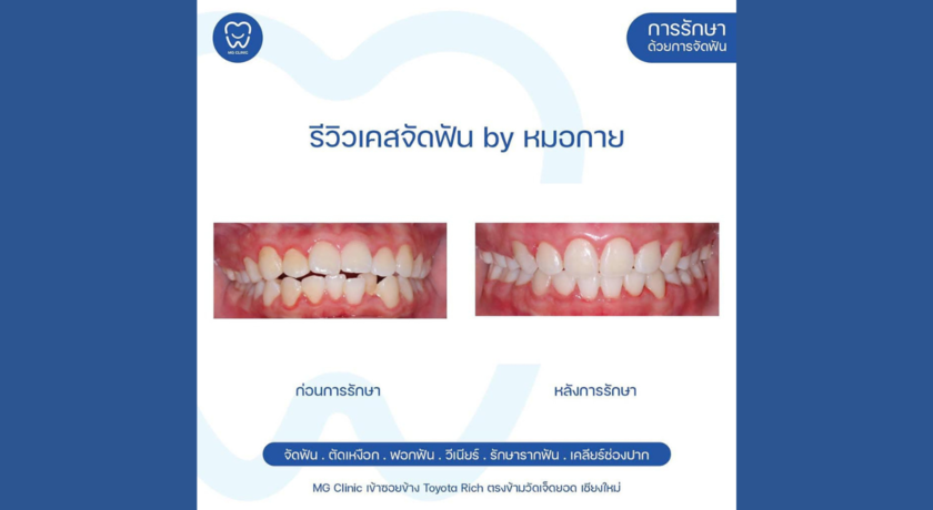 MG Dental Clinic (Santitham Branch)  8