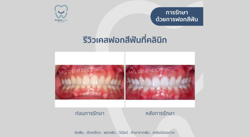 MG Dental Clinic (Santitham Branch)  9