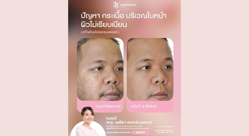 Kanchanok Clinic (Big C SukSawat)  26