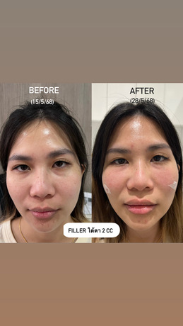 Dermina Clinic (Bangna) เดอมินา คลินิก (บางนา) image_picker_34C9EF18-0DC9-4852-B81F-BFFEB52BBCCE-9877-00000720118CEDAC