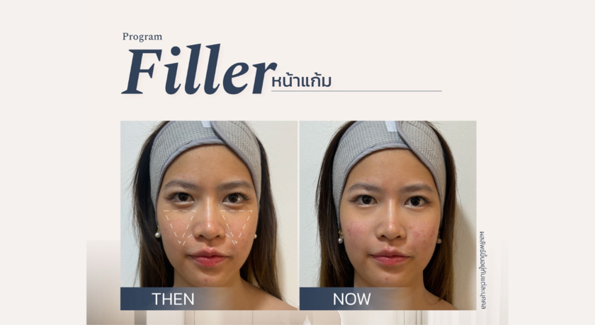 Acqua Wellness Clinic (Sukhumvit 31)  7