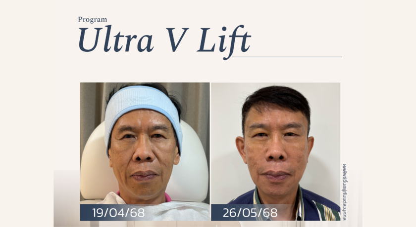 Acqua Wellness Clinic (Sukhumvit 31)  9
