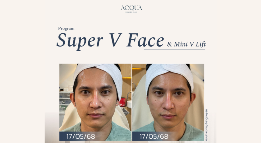 Acqua Wellness Clinic (Sukhumvit 31)  10