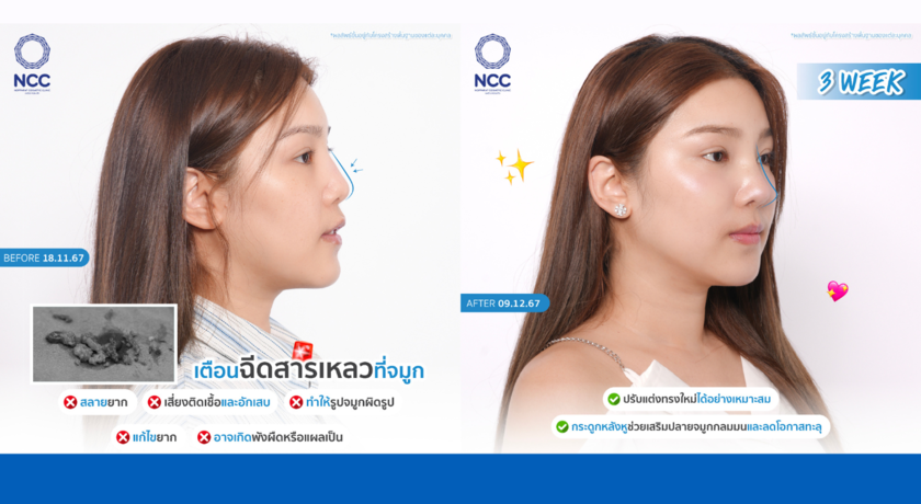 Nopparat Cosmetic Clinic  10