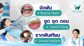 GT Smile Dental Clinic (Lat Phrao71) GT Smile Dental Clinic - จีทีสไมล์ คลินิกทำฟันครบวงจร ลาดพร้าว71 1