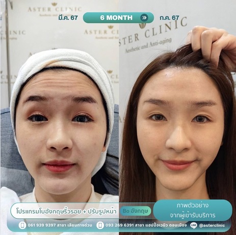 Aster Clinic อัสเธอร์คลินิก  (เลียบทางด่วนเอกมัยรามอินทรา - Ladprao 71)  line_oa_chat_250624_161218