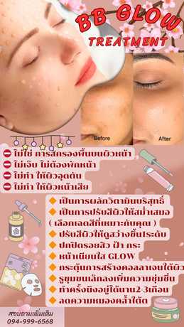 Charming Eyebrows & Lips ชาร์มมิ่ง อายบราวน์ แอนด์ ลิป scaled_1000047239