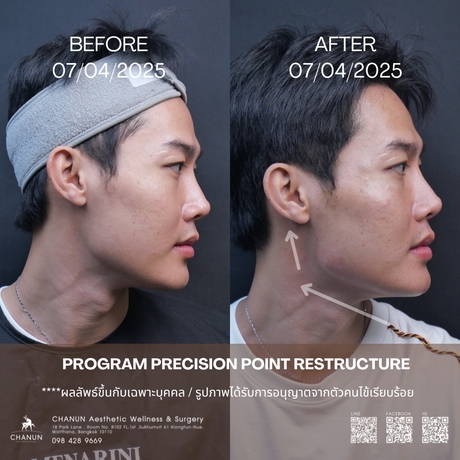 Chanun Aesthetic&Wellness  6