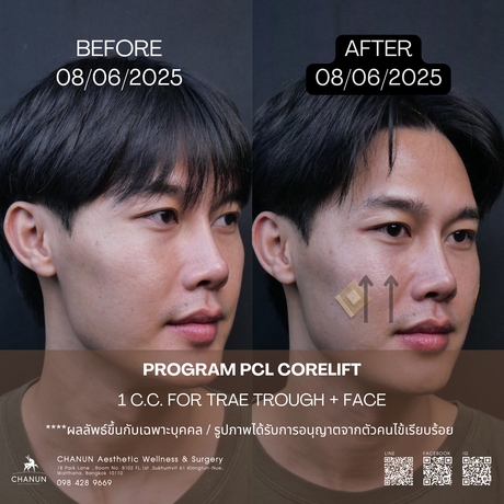 Chanun Aesthetic&Wellness  13