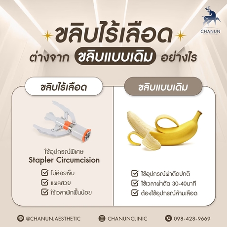 Chanun Aesthetic&Wellness  LINE_ALBUM_ads20_5_250715_1