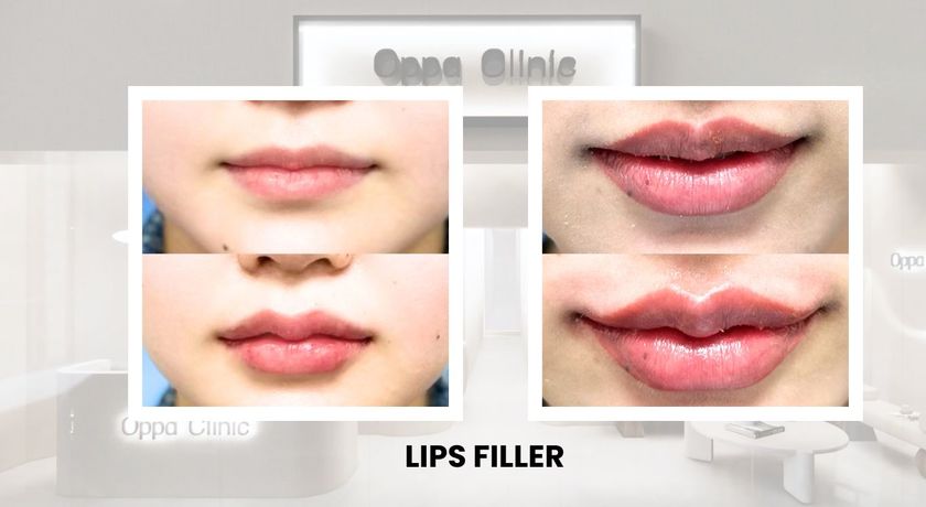 Oppa Clinic (MBK FL.6)  9