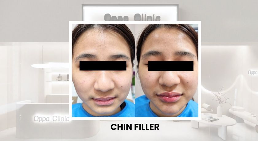 Oppa Clinic (MBK FL.6)  18