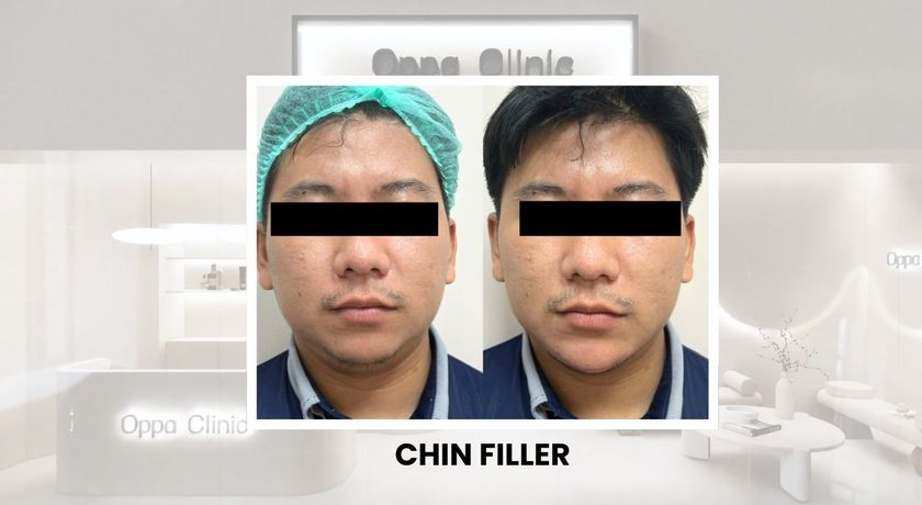 Oppa Clinic (MBK FL.6)  22