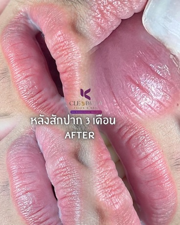 Cleopatra Relax&Nails Chiang Mai  image_picker_B1EA1054-5BF2-4900-A449-862523127D2C-11886-0000046ACB38CE6A