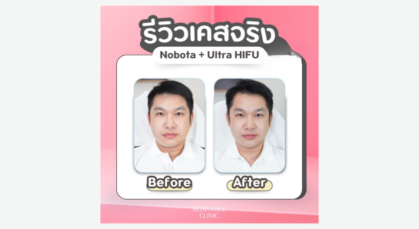 Medivisage Clinic (Rama 9)  3