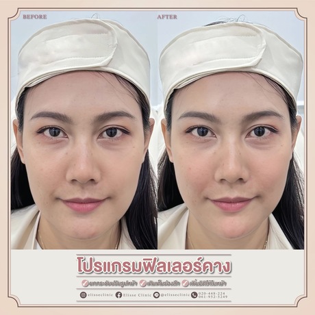 Enchante Clinic Enchante Clinic (อองชองเต คลินิก) image_picker_3FE1BD86-5521-41D1-8B95-03FF3AC2609F-6815-00000153D8CAD83E