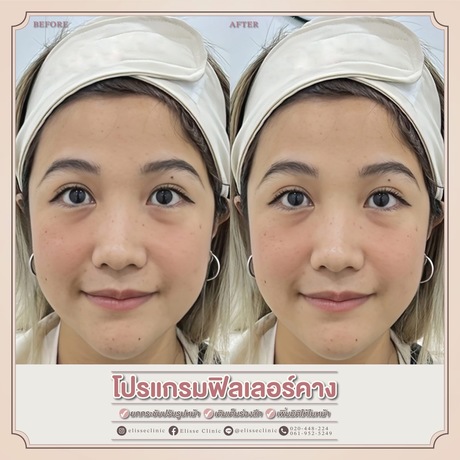 Enchante Clinic Enchante Clinic (อองชองเต คลินิก) image_picker_EFBB28AD-F8AE-4A8C-A8F4-4F79F4B5993C-6815-00000153D7BB926D