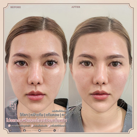 Enchante Clinic Enchante Clinic (อองชองเต คลินิก) image_picker_DA93D4F6-64E4-4CB2-A1FB-083FED47AD73-6815-00000153D7D67187