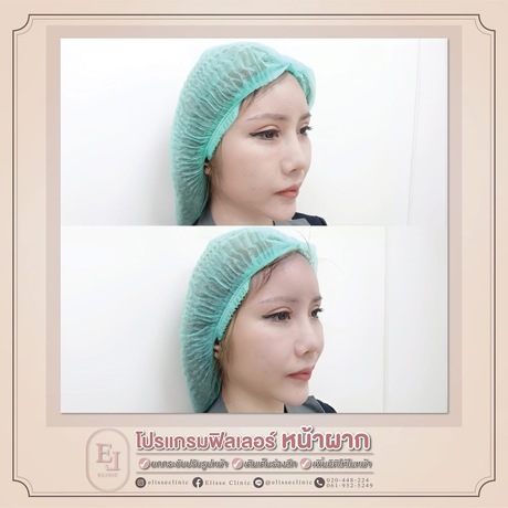 Enchante Clinic Enchante Clinic (อองชองเต คลินิก) image_picker_C8D995E8-8A03-4E0A-8471-38159B25DDB1-6815-00000153D865C1D9