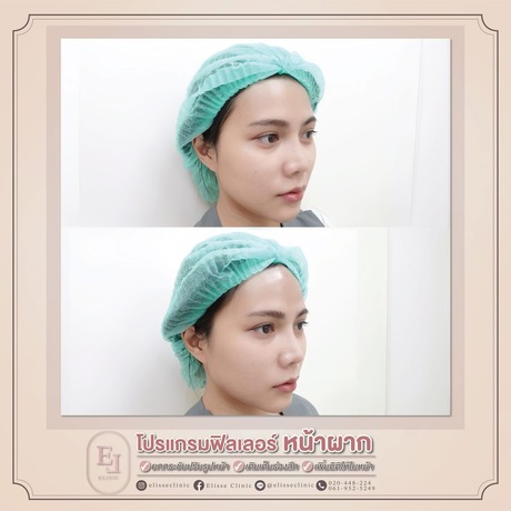 Enchante Clinic Enchante Clinic (อองชองเต คลินิก) image_picker_4BF3C7F6-BD73-442D-AEA1-61961FEB2981-6815-00000153D8564D74