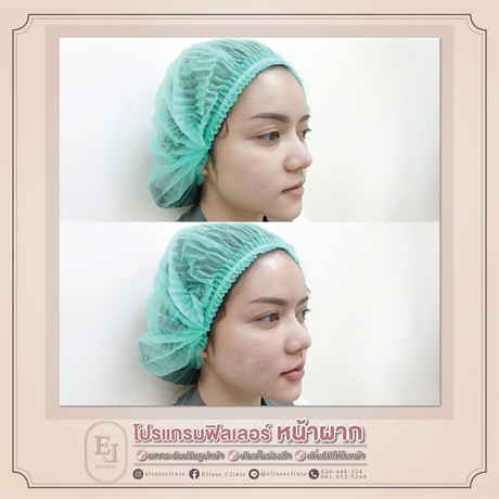 Enchante Clinic Enchante Clinic (อองชองเต คลินิก) image_picker_3750EBC5-38FD-4F81-AC7A-126279E96727-6815-00000153D89C813C
