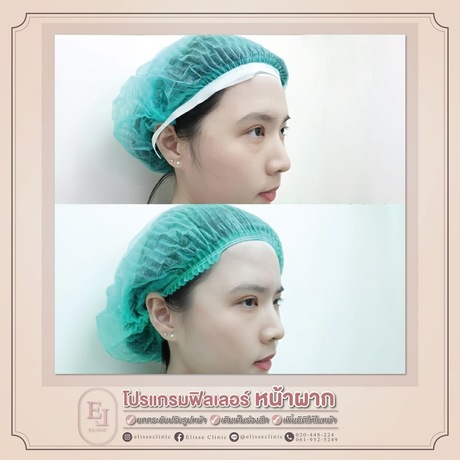 Enchante Clinic Enchante Clinic (อองชองเต คลินิก) image_picker_DE4A4E00-04F9-42DF-BD57-FBE9EB67E80E-6815-00000153D8753FEC