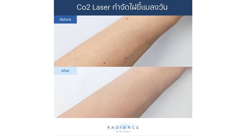Radiance Skin Clinic (BTS Chidlom)  7