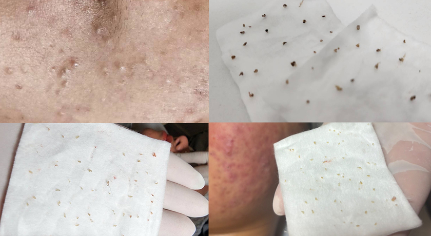 KLEAR Skin and Body Club  %E0%B8%97%E0%B8%97%E0%B8%97%E0%B8%97%E0%B8%97%E0%B8%A1%E0%B8%A1