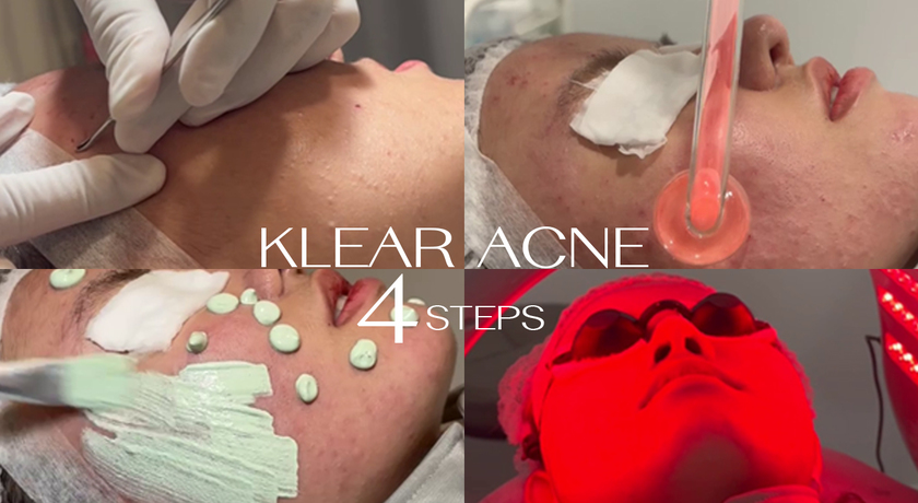 KLEAR Skin and Body Club  %E0%B8%B7%E0%B8%97%E0%B8%B7%E0%B8%97%E0%B8%B7%E0%B8%97%E0%B8%B7%E0%B8%97