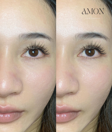 Amon lash Thailand  image_picker_968F20C5-F191-46F3-99C6-E3AA563326F4-63085-000011DFE9BF135E