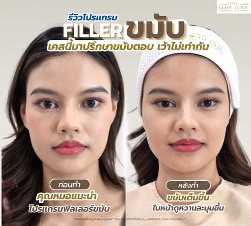 The Glow Clinic  scaled_1000048535