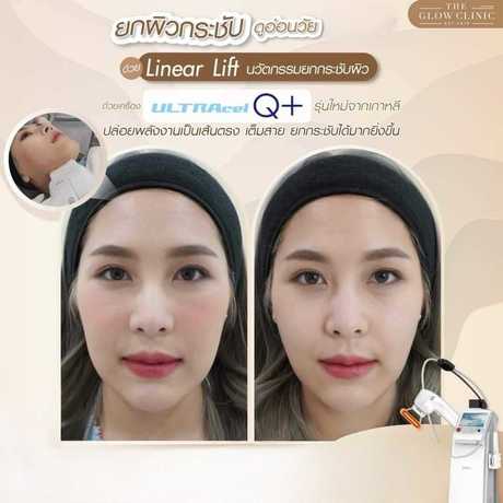 The Glow Clinic  scaled_1000048536