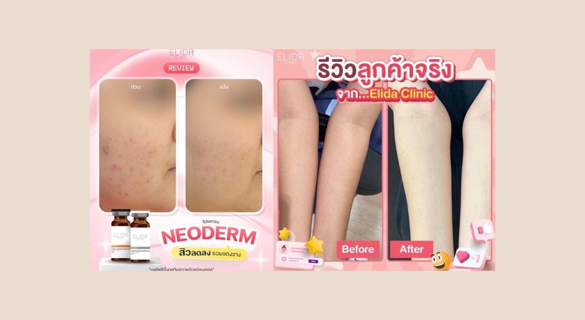ELIDA Clinic (Rangsit Branch)  6