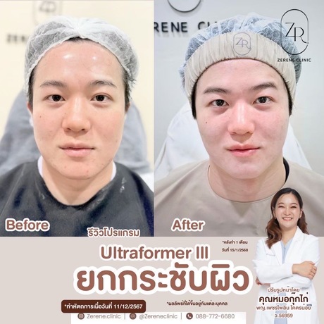 Zerene Clinic  image_picker_C4928347-DD62-4BA5-B9AC-249DB8795BA3-6159-000001C12ADA6FA9