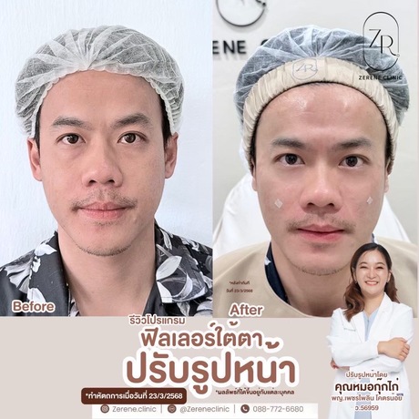 Zerene Clinic  image_picker_F87E4B69-7DE2-41AA-A2FB-FEC04909E52E-6159-000001C44BA1C1CF