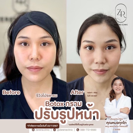Zerene Clinic  image_picker_6F625FEB-0AFA-4822-A52C-C46C4FEDDDCF-6159-000001C44BA69984