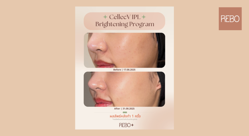 Rebo Clinic (L floor Park Silom) Rebo Clinic - รีโบ คลินิก ความงามใจกลางสีลม 39