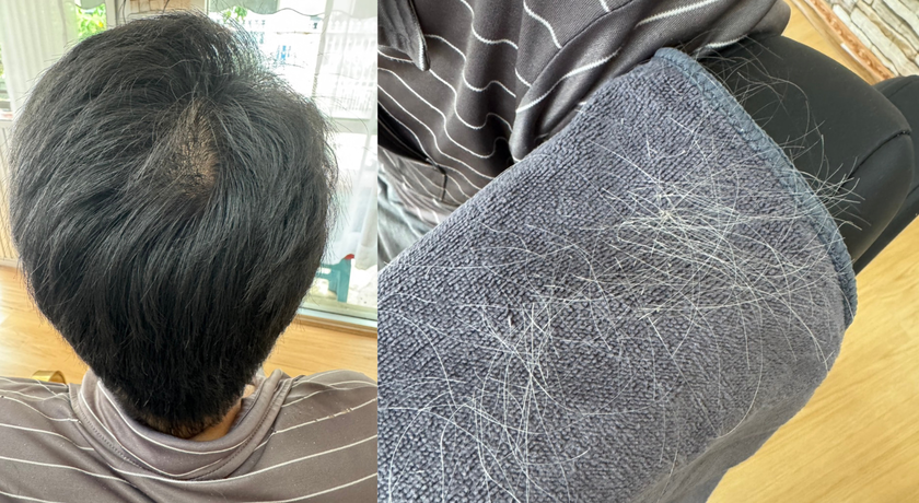 Service for Plucking Gray Hair รับถอนผมหงอกพระราม 3 4