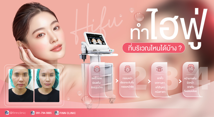 Finn Clinic  hifu